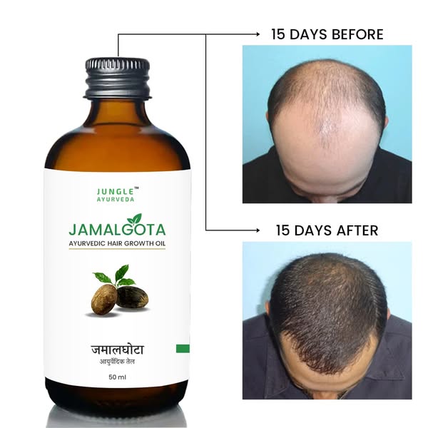𝗝𝗮𝗺𝗮𝗹𝗴𝗵𝗼𝘁𝗮 𝗛𝗮𝗶𝗿 𝗚𝗿𝗼𝘄𝘁𝗵 𝗢𝗶𝗹 – 𝗘𝗮𝗰𝗵 𝟯𝟬𝗺𝗹 (𝗣𝗮𝗰𝗸 𝗼𝗳 𝟮) | 𝗙𝗮𝘀𝘁 𝗛𝗮𝗶𝗿 𝗥𝗲𝗴𝗿𝗼𝘄𝘁𝗵 𝗙𝗼𝗿𝗺𝘂𝗹𝗮